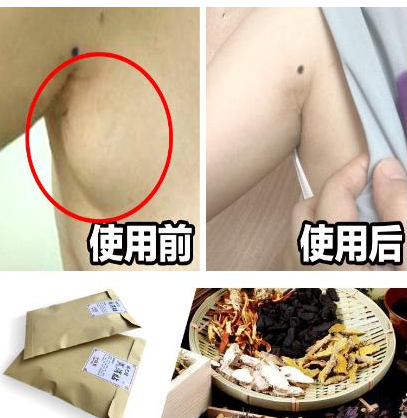 如何消除副乳防止下垂？你要熟知的4个选内衣知识