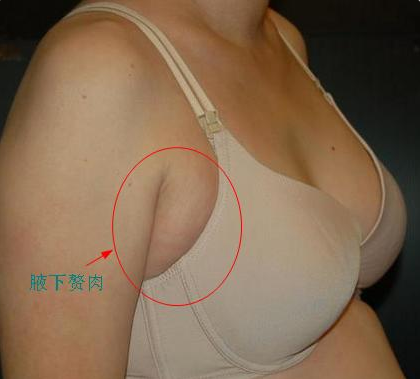 文胸穿起来显副乳，穿内衣老有副乳怎么收