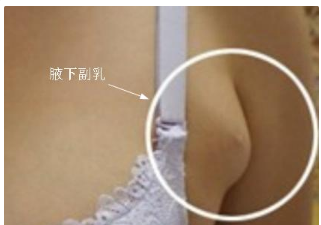 副乳怎么收紧文胸内，收副乳文胸有哪些，怎样挑选