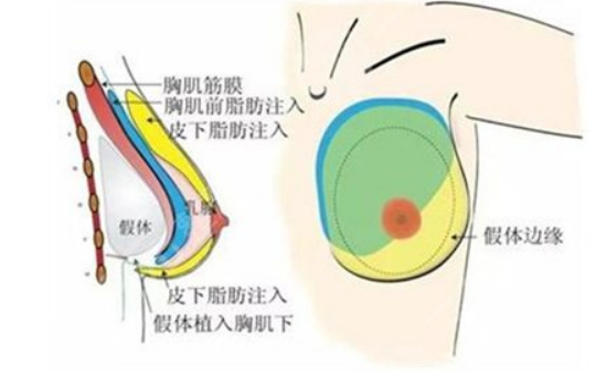 c奶是什么样子的,c罩杯多大胸图片欣赏