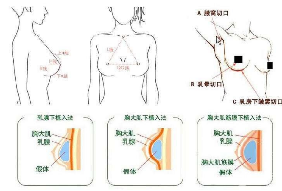 c奶是什么样子的,c罩杯多大胸图片欣赏